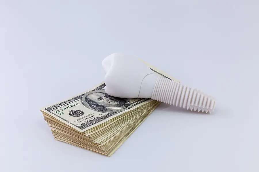 Why are Dental Implants So Expensive?