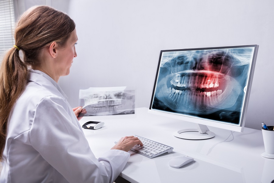 How Does a 3D Cone Beam CT X-ray Benefit Me?
