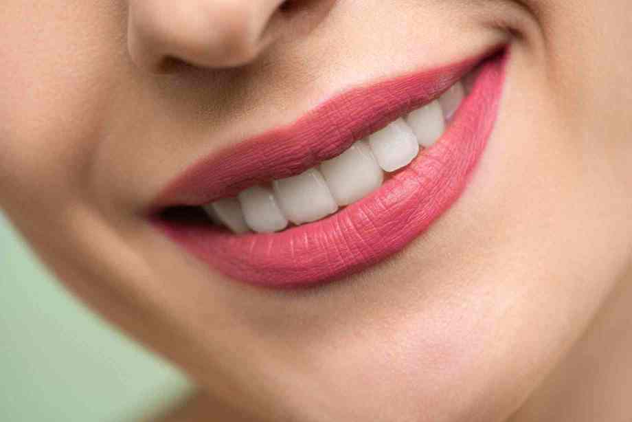 Zoom Whitening